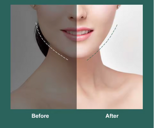 Face Lift Up Belt